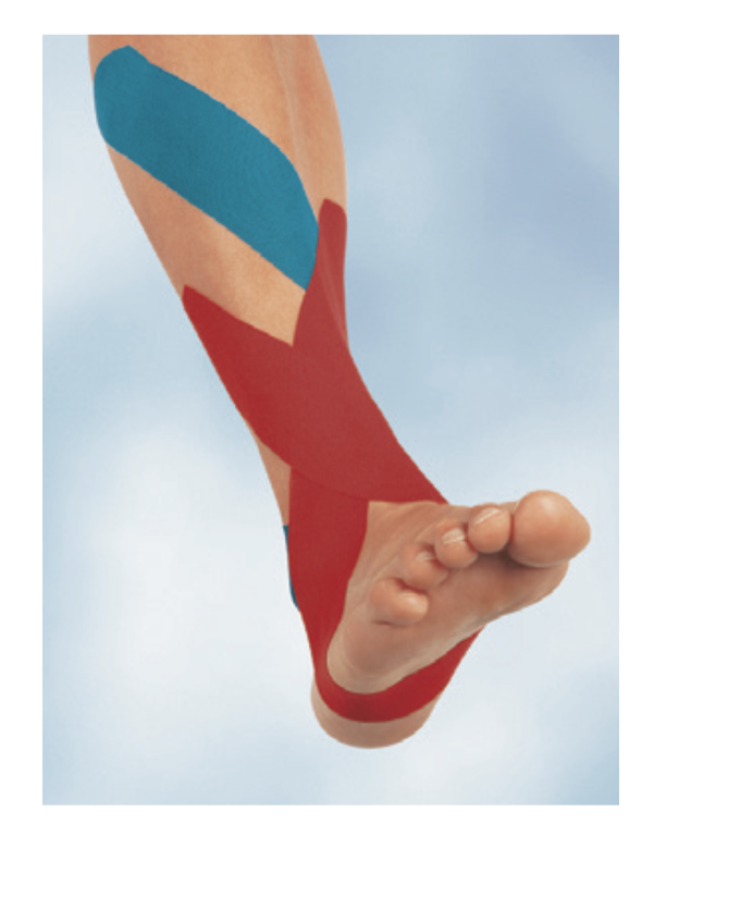 BSN Medical Leukotape K - Kinesiology Therapeutic Adhesive Tape
