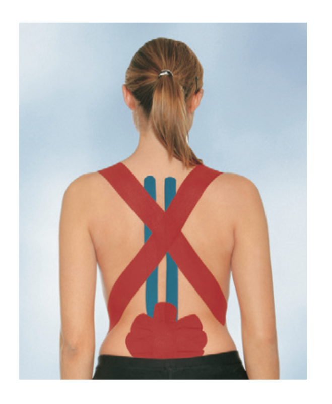 BSN Medical Leukotape K - Kinesiology Therapeutic Adhesive Tape